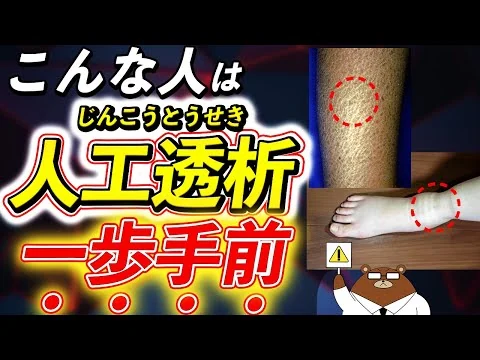 画像 【危険】腎臓からの超意外なSOSを絶対見逃さないで！目、皮ふ、足..透析寸前のサインとは。「尿毒症」とは何か？腎臓病の予防法とは？医師が徹底解説！
