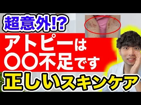 画像 【なぜ報道しない?】アトピーが治らない人の特徴【医師が行うスキンケアとは?】アトピー性皮膚炎の治療法を完全解説