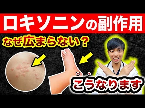 画像 【なぜ知られない?】ロキソニンを毎日飲むと『体が変化』します。【危険】現役医師解説｜湿布や市販薬のオススメは？