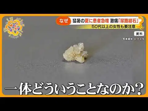 画像 【猛暑】耐えがたい激痛 ｢尿路結石｣ 患者急増 50代以上の女性も要注意！ “理由は脱水”
