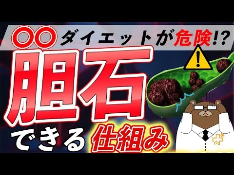 画像 【衝撃】意外に知られていない、「胆石」ができる仕組みとは？予防法とは？